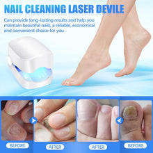 Rechargeable Nail Fungus Laser  Anti-Fungal Device Toenails, Hands & Feet (Home Use)